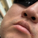 レス1番のサムネイル画像