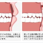 レス25番のサムネイル画像