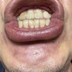 レス54番のリンク先のサムネイル画像