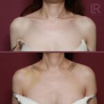 レス2番の画像2