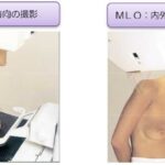 レス31番の画像1